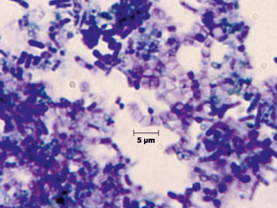 Bacillus megaterium