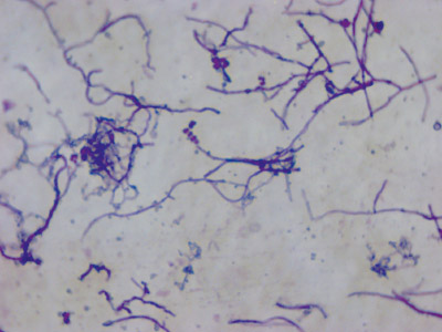Steptomyces griseus