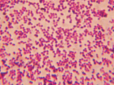 Neisseria spezies