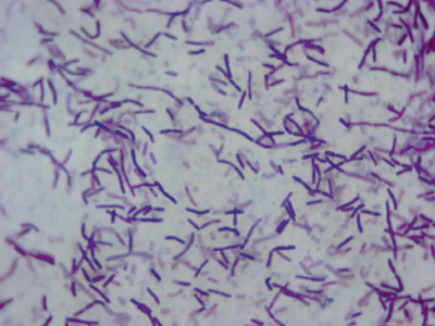 Mycobakterium phlei