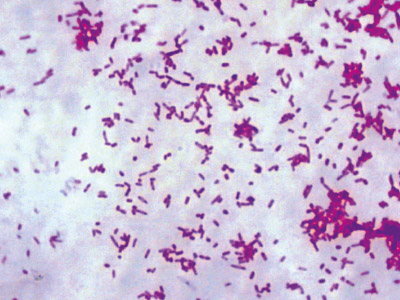 Escherichia coli