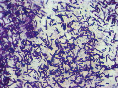 Bacillus subtilis