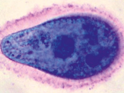 Nierentierchen 3