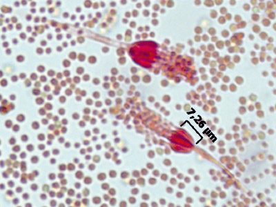 Penicillium glabrum