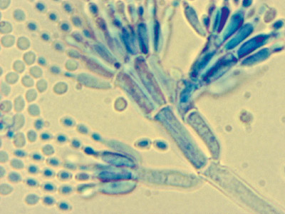 Penicillium olsonii