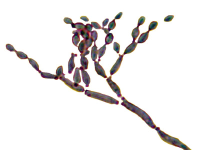 Cladosporium spezies