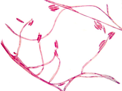 Fusarium solani