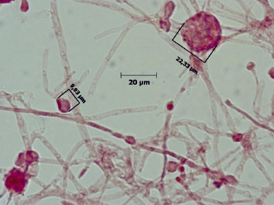 Monascus ruber