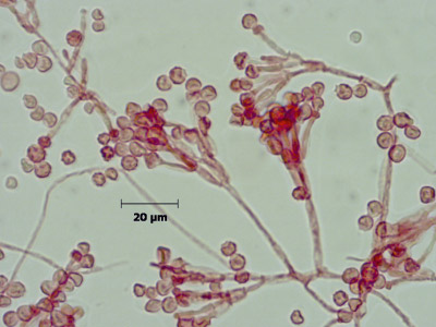Scopulariopsis brevicaulis