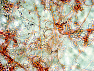 Trichophyton interdigitale