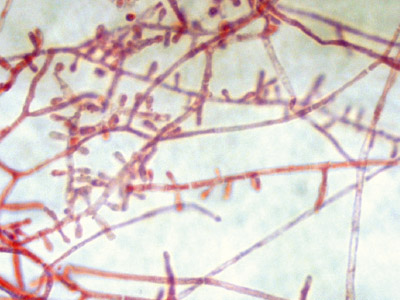 Trichophyton rubrum