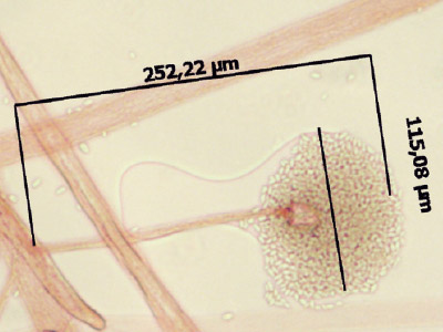 Mucor indicus