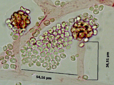 Mucor racaemosus