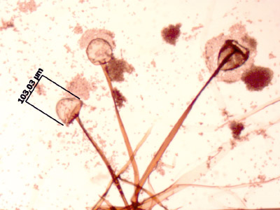 Rhizopus oryzae