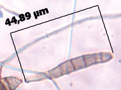 Alternaria tenuis