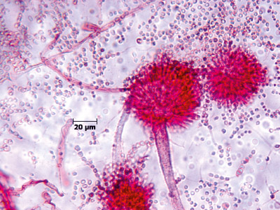 Aspergillus flavus