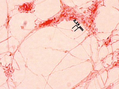 Acremonium spezies