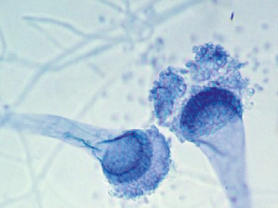 Aspergillus fumigatus