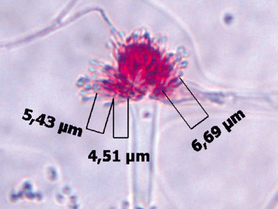 Aspergillus vesicolor
