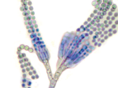 Penicillium citrinum
