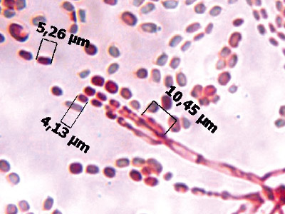 Penicillium digitatum
